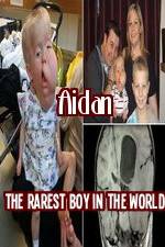 Watch Aidan The Rarest Boy In The World Xmovies8