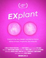 Watch Explant Xmovies8