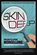 Watch Skin Deep: The Battle Over Morgellons Xmovies8
