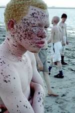 Watch Albino United Xmovies8