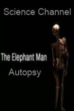 Watch Science Channel Elephant Man Autopsy Xmovies8