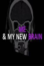 Watch Me & My New Brain Xmovies8