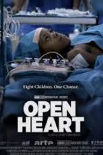 Watch Open Heart Xmovies8