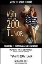 Watch The Man With The 200lb Tumor Xmovies8