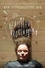 Watch My Beautiful Broken Brain Xmovies8