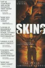 Watch Skins Xmovies8