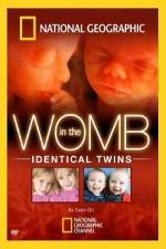 Watch National Geographic: In the Womb - Identical Twins Xmovies8