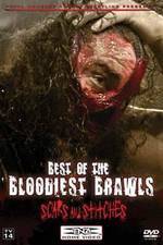 Watch TNA Wrestling: Best of the Bloodiest Brawls - Scars and Stitches Xmovies8