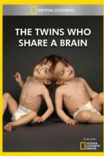 Watch National Geographic The Twins Who Share A Brain Xmovies8