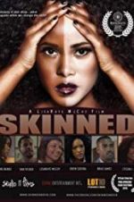 Watch Skinned Xmovies8