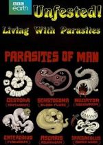 Watch Infested! Living with Parasites Xmovies8