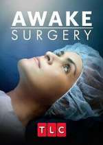 Watch Awake Surgery Xmovies8
