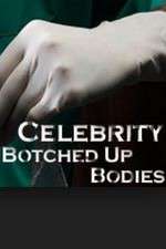 Watch Celebrity Botched Up Bodies Xmovies8